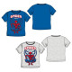 Anterior